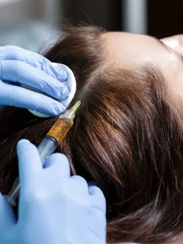 PRP Hair Treatment treatment at Scalp & Art Nottingham